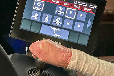 A hand deformed by butterfly disease grips a joystick. Behind it is an active touchscreen.