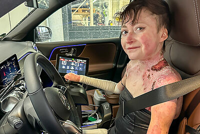 A young woman with a slight smile, suffering from erythema multiforme (open sores on her shoulder and neck), sits in the driver's seat with her seatbelt fastened, a joystick in her hand, and ready to go.